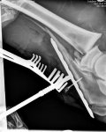 Hardy_intraop_1a (2).jpg