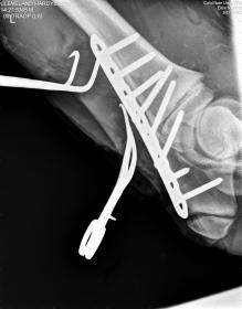 My mule with his hopefully repaired elbow joint. cross your fingers!